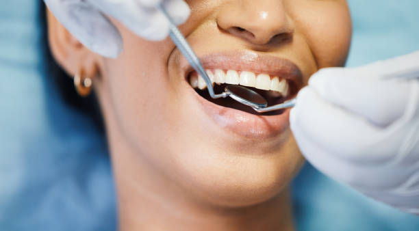 Best Tooth Infection Emergency Dentist  in Staic, CA